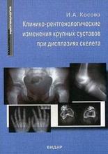Клинико-рентгенологические изменения крупных суставов при дисплазиях скелета. Косова И.А. 2006 г.