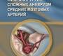 Микрохирургия сложных аневризм средних мозговых артерий. Пилипенко Ю.В. 2025