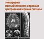 Магнитно-резонансная томография при заболеваниях и травмах центральной нервной системы. Холин А.В. 2019 г.