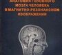 Анатомия мозга человека в магнитно-резонансном изображении. Холин А.В. 2005 г.