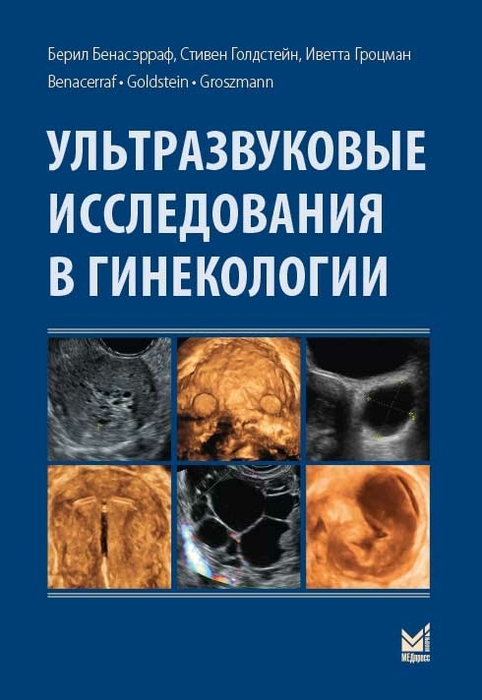 Ультразвуковые исследования в гинекологии. Бенасэрраф Б. 2016 г.