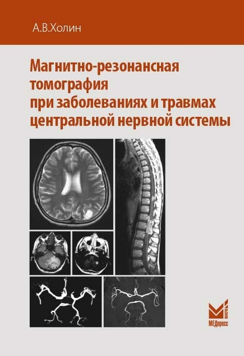 Магнитно-резонансная томография при заболеваниях и травмах центральной нервной системы. Холин А.В. 2019 г.