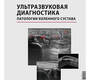 Ультразвуковая диагностика патологии коленного сустава. Сенча. 2026 г.