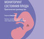 Кардиотокография. Мониторинг состояния плода. Сяохуэй. 2025 г.