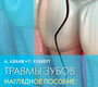 Травмы зубов. Наглядное пособие. Алани. 2024 г.