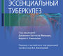 Эссенциальный туберкулез. Мильори. 2025 г.