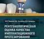 Рентгенологическая оценка качества имплантационного протезирования. Паршин. 2024г.