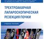 Трехтроакарная лапароскопическая резекция почки. Глыбочко.2025 г.