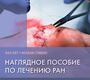 Наглядное пособие по лечению ран.   2025 г.