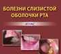 Болезни слизистой оболочки рта. Атлас. Черкесова. 2025 г.