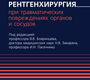 Экстренная и неотложная рентгенхирургия при травматических повреждениях органов и сосудов. Бояринцев. 2022г.