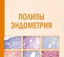 Полипы эндометрия. Казачков. 2025 г.