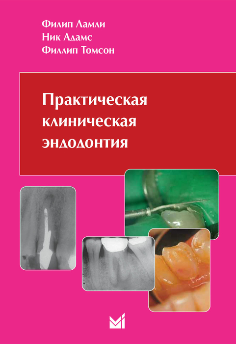 Практическая клиническая эндодонтия. Ламли Ф. 2007 г.