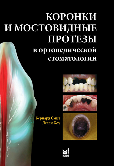 Коронки и мостовидные протезы в ортопедической стоматологии. Смит Бернард. 2010 г.