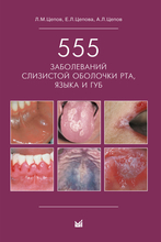 555 заболеваний слизистой оболочки рта, языка и губ. Цепов Л.М., Цепова Е.Л., Цепов А.Л. 2015 г.