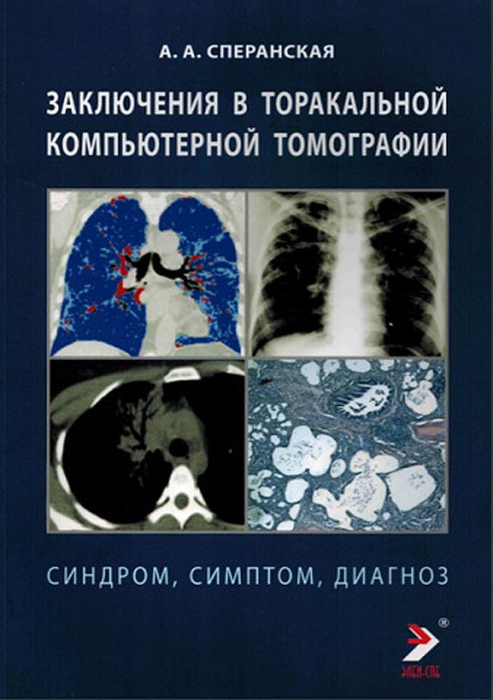 Заключения в торакальной компьютерной томографии. Сперанская.  2024г.
