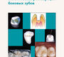 Эстетическая реставрация боковых зубов. Вкладки и накладки. Гарбер Д.А. 2009 г.