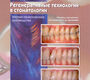 Регенеративные технологии в стоматологии. Научно-практическое руководство. Барон А., Нанмарк У. 2015 г.