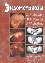 Эндометриозы. Руководство для врачей. 2-е изд., перераб. и доп. Л.В. Адамян. 2006г.