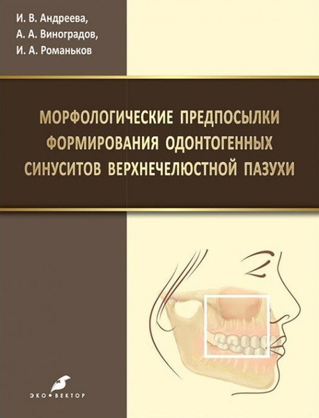 Морфологические предпосылки формирования одонтогенных синуситов верхнечелюстной пазухи. Андреева. 2019 г.