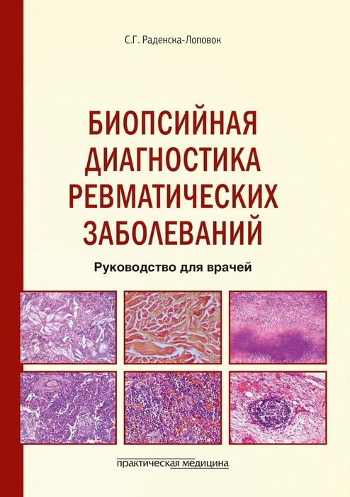 Биопсийная диагностика ревматических заболеваний. Раденска-Лоповок С.Г. 2024г.