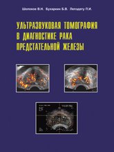 Ультразвуковая томография в диагностике рака предстательной железы. В.Н. Шолохов, Б.В. Бухаркин, Лепэдату П.И.