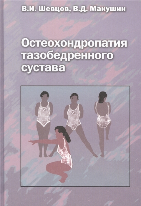 Остеохондропатия тазобедренного сустава. Руководство для врачей. В.И. Шевцов, В.Д. Макушин. 2007г. 